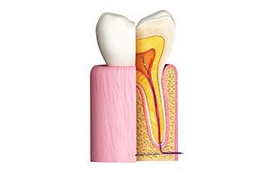 Anatomie de la dent